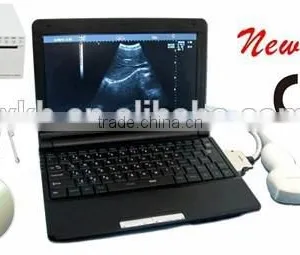 CE Low Price Large Screen Good Image Laptop Ultrasound Scanner Machine For Sale With Convex,Linear, Vaginal Tranducer-RUS-9000F thumbnail-1