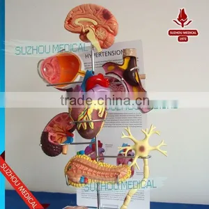 Effects of Hypertension, 5 Parts thumbnail-1