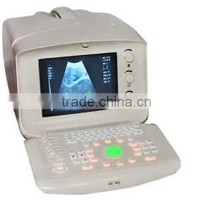 2016 CE Approved Digital Portable Style Ultrasound Machine/Scanner With Cheap Price thumbnail-3