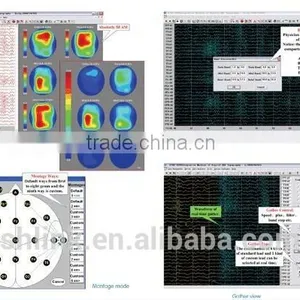 Best China Optical Instrument KT88-2400 Digital EEG And Mapping System thumbnail-2