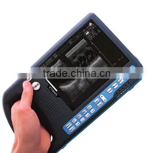 Ultrasound Scanner (WG-3000) thumbnail-1