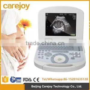 2017 New Digital Portable Ultrasound Scanner Suitable for the Diagnosis of Abdomen, Cardiac, Gynecology, Obstetrics thumbnail-1