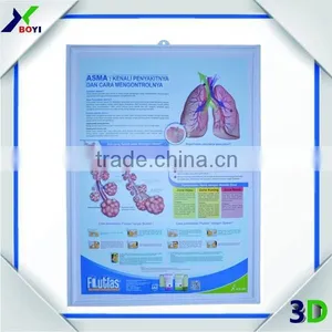 Embossed Pvc 3d Medical Poster/anatomical Chart (pregnancy) thumbnail-3