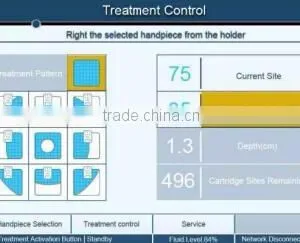 Top Selling Vertical Cryo Cell Freezing Machine thumbnail-5