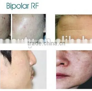 The Multifunctional and Effective Portable HIFU Focused Ultrasonic Fat Removal for Beauty Center and Clinic thumbnail-6