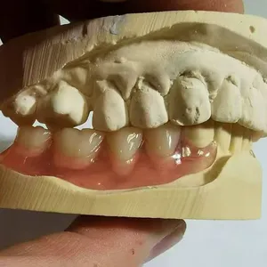Quality Implant Crown and Bridge Manufacturers & Exporter - Buy Total Implant PFM Bridge China Dental Lab From China Manufacturer. thumbnail-1