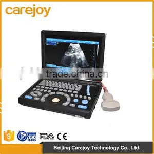 CE Approved Notebook Ultrasound Scanner With 3.5Mhz Multi-frequency Convex Probe RUS-9000E2 thumbnail-1