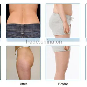 Body Slimming Coolplas Criolipolysis Weight Loss Fat Freezing Anti Cellulite Body Slimming Machine Body Massager Machine thumbnail-3