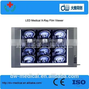 High Brightness Medical x Ray Film Viewer thumbnail-1
