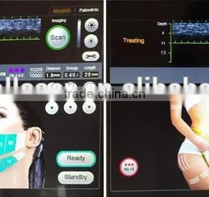 Raynol 2016 EShape-III 5 Transducers HIFU Face and Body Machine thumbnail-6
