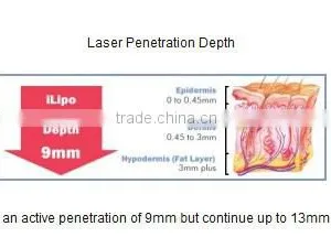Osano Lipo Laser Cellulite Reduction Treatment Device thumbnail-6