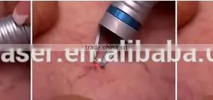 QTS 2016 Blood Vessels Spider Veins Removal ,with 980nm Wavelength Laser thumbnail-4