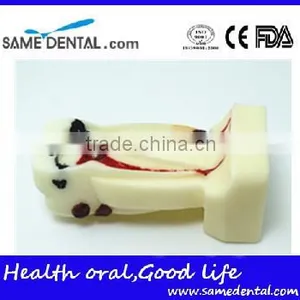 .See Larger Image 4 Times Integrated Pathology Model Dental Eduction Assitant No. DEA-15 thumbnail-3