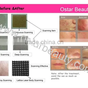 Medical Co2 Laser Machine for Scar Removal thumbnail-3