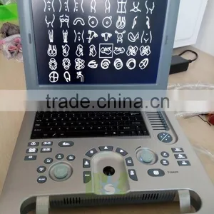 Ultrasound Machine ,ultrasound Machine Price,ultrasound Scanner thumbnail-1