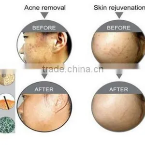 Professional Skin Care Machine thumbnail-5