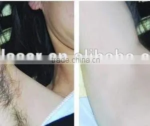 755+1064 Alexandrite Laser Permanent Hair Removal Machine Pigmentation Correctors thumbnail-2