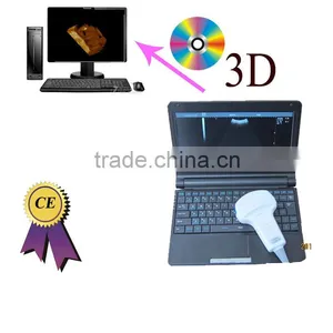 Factory Price! CE Approved Cheap Ultrasound Scanner With 3.5Mhz Convex Probe thumbnail-1
