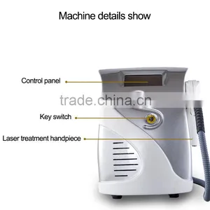 Q-swithched ND:YAG Laser Machine Laser Tattoo Removal q Switched nd Yag Laser / Laser Tattoo Removal / Tattoo Removal Machine thumbnail-6