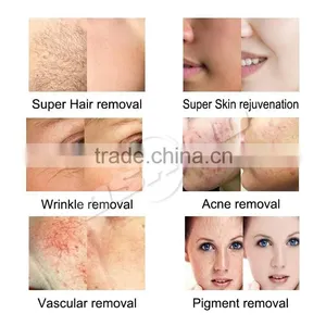 Loss Weight Beauty Machine With Face Lift 1.0-10mm Hifu Machine For Body Treatment Nasolabial Folds Removal Improve Blood Circulation thumbnail-6