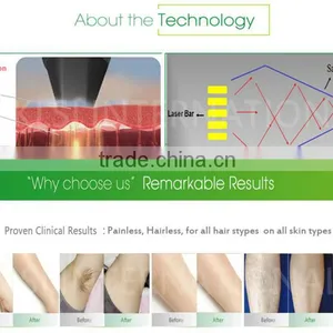 HOT!!!Vertical 808nm Diode Laser Hair Removal Beauty Equipment&machine thumbnail-5