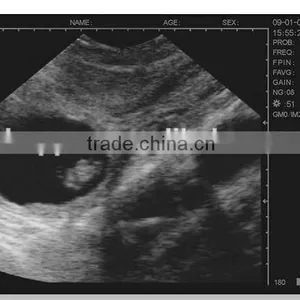 Cheap Mobile Vet Ultrasound Machine Price M50 thumbnail-3