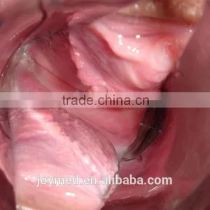 CE Video Colposcope Ultrasound thumbnail-3