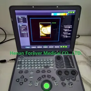 Color Doppler/Best Ultrasonography/ Doppler Scan thumbnail-1