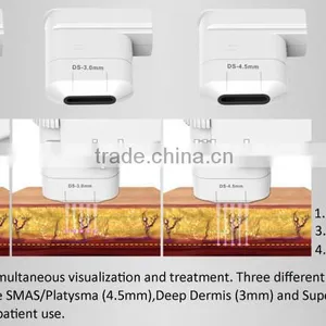 Manufactory China HIFU Hifu Technology Anti Fatty Portable HIFU Treatment Principle With Three Transducer DS4/DS7/DS10 thumbnail-4