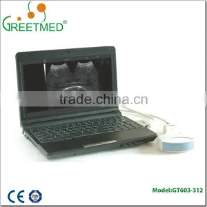 High Quality New Design Cheap Ultrasound Machine thumbnail-4