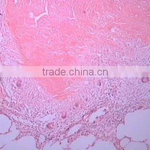 Superfine Medical Prepared Microscope Slides of Moving-point Muscle thumbnail-4