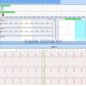CE Approved 12 Channel Mini 24/48-hour LCD ECG Holter Recorder System With Premier Holter Software-ECGLAB thumbnail-2