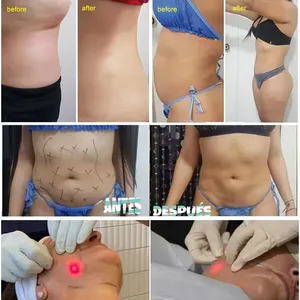 Durable Stainless Steel Laser Hair Removal Machine With Medical-Grade Materials thumbnail-4