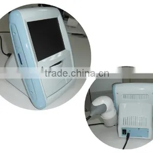 CareScan-1 Bladder Scanner Diagonosis Portable Scanner thumbnail-4