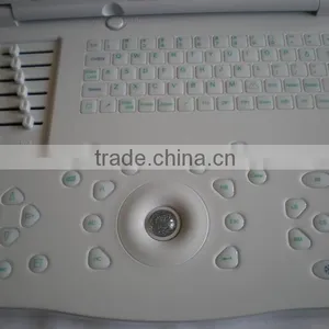 CE Approved Portable Ultrasound Scanner With 3.5Mhz Multi-frequency Convex Probe RUS-9000E thumbnail-2
