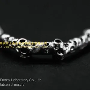 Dental Implant Bar, Implant Overdenture, Implant Prosthesis, Laboratoire Dentaire, Dentallabor, Laboratorio Dental, Dental Laboratory, Shenzhen LJ Dental Lab China thumbnail-1