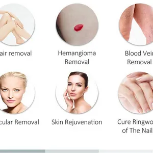 ADM Alexandrite Laser for Face and Body 755nm 1064nm Alexandrite Laser Hair Removal Beauty Machine 755 Alexandrite Laser thumbnail-6