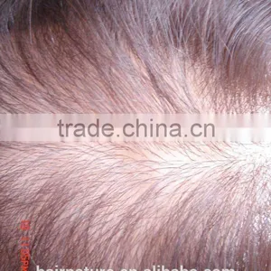 Injected Lace Hair Pieces thumbnail-1