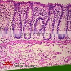 75pcs Anatomy Prepared Slides Set for School Teaching thumbnail-2