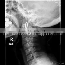 Konida Medical X-ray Film Agfa Fuji Dry Film/x-ray Automatic Medical Film Processor thumbnail-1