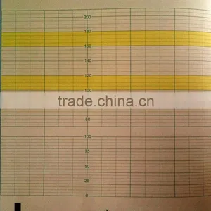 Fetal Monitor Paper / 152mm*150mm-150p Fetal Monitor Recording Paper for Toitu thumbnail-1