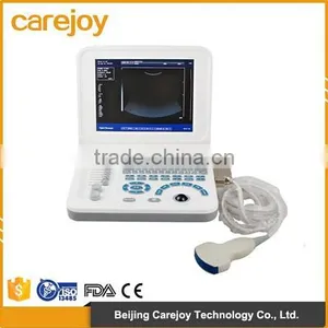New Laptop Ultrasound Scanner Ultrasonic Diagnostic System RUS-9000F2 thumbnail-1