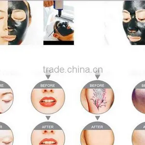 Beautiful nd Laser Tattoo Removal Beauty Equipment thumbnail-5