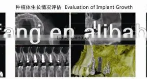 Digital 3D Intra-oral Imaging X-ray Machine thumbnail-1