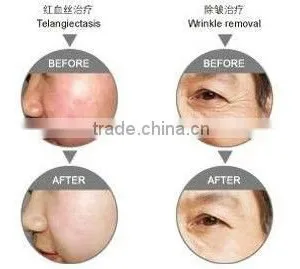 Multi-functional Wrinkle Removal and Body Care Spa Salon Equipment thumbnail-3