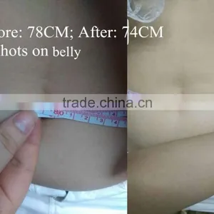 Cryolipolysis Cold Body Scuplting Machine for Spa / Cryolipolysis Machine Price thumbnail-2