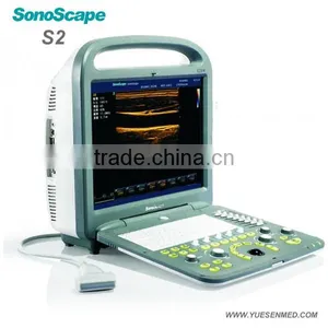 Color Ultrasound Scanner Sonoscape Veterinary Ultrasound thumbnail-4