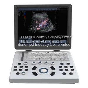 High Quality Ultraslim Notebook Type Black and White Ultrasound Scanner thumbnail-3