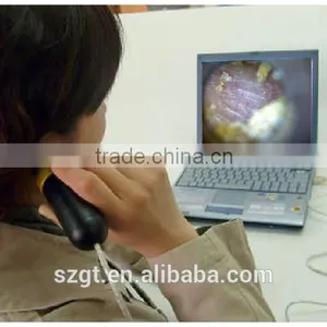 Eardrum Scope Camera thumbnail-3