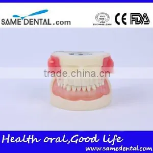 Abscess and Tooth Preparation Model School Teaching Demonstration thumbnail-2